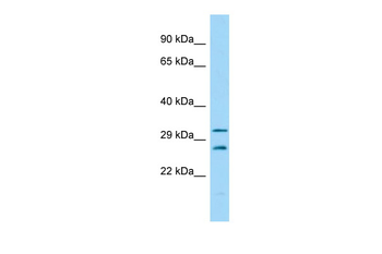 Csnk2b Rabbit Polyclonal Antibody