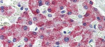 ACAA1 Rabbit Polyclonal Antibody