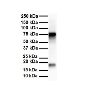 APEH Rabbit Polyclonal Antibody