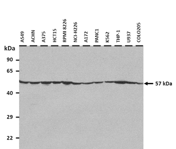 ATP5F1B Rabbit Polyclonal Antibody