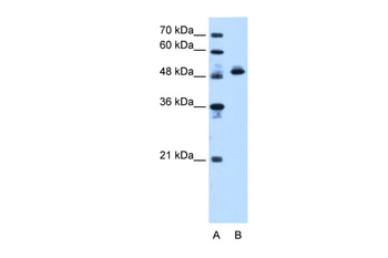 ATP5F1B Rabbit Polyclonal Antibody