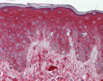 DCN Rabbit Polyclonal Antibody