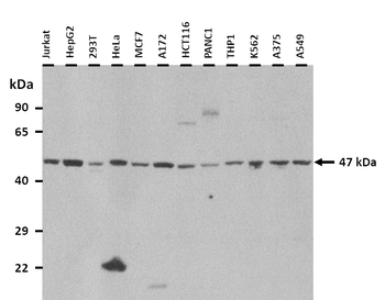 ENO3 Rabbit Polyclonal Antibody