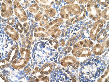 ENO3 Rabbit Polyclonal Antibody