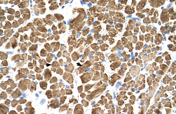 TPM2 Rabbit Polyclonal Antibody