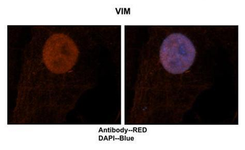 VIM Rabbit Polyclonal Antibody