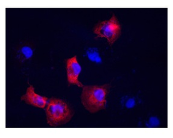 VIM Rabbit Polyclonal Antibody