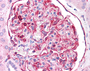 VIM Rabbit Polyclonal Antibody