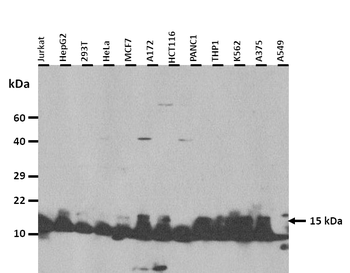 PFN1 Rabbit Polyclonal Antibody