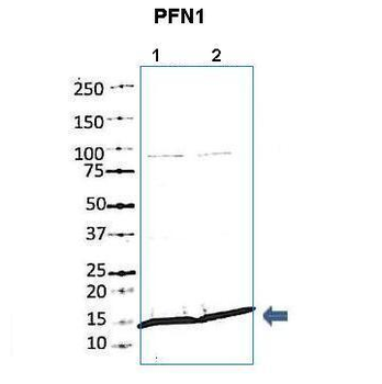 PFN1 Rabbit Polyclonal Antibody