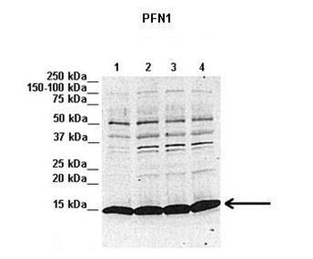 PFN1 Rabbit Polyclonal Antibody