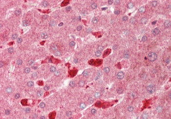 PFN1 Rabbit Polyclonal Antibody