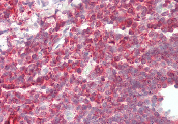 PFN1 Rabbit Polyclonal Antibody