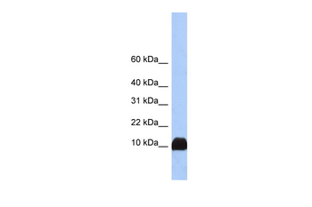 PFN1 Rabbit Polyclonal Antibody