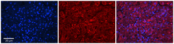 GRHPR Rabbit Polyclonal Antibody
