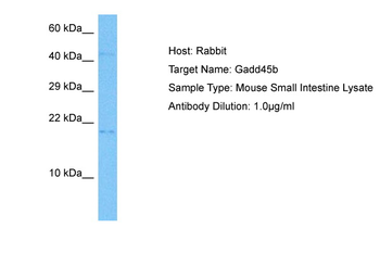 GADD45B Rabbit Polyclonal Antibody