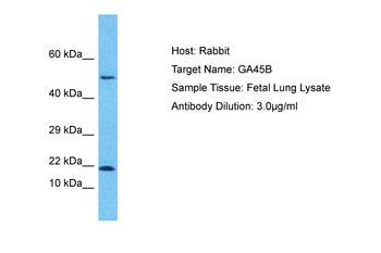 GADD45B Rabbit Polyclonal Antibody