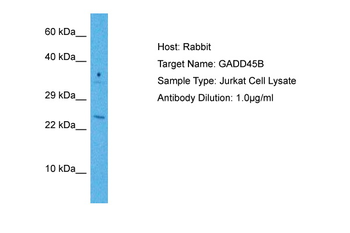 GADD45B Rabbit Polyclonal Antibody