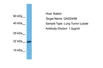 GADD45B Rabbit Polyclonal Antibody