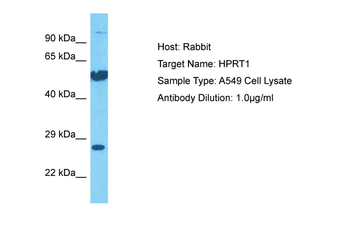 HPRT1 Rabbit Polyclonal Antibody
