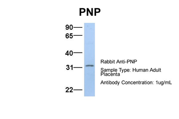 NP Rabbit Polyclonal Antibody