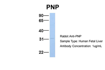 NP Rabbit Polyclonal Antibody