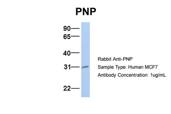 NP Rabbit Polyclonal Antibody