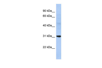 NP Rabbit Polyclonal Antibody