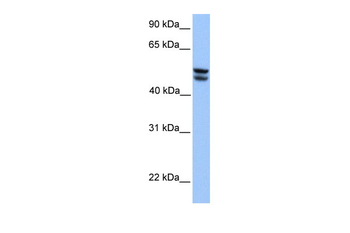 OXCT1 Rabbit Polyclonal Antibody