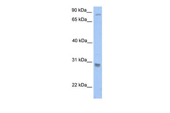 GSTT1 Rabbit Polyclonal Antibody