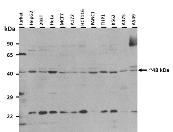 GATM Rabbit Polyclonal Antibody