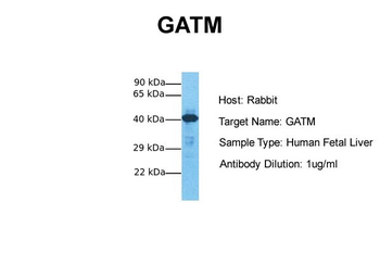 GATM Rabbit Polyclonal Antibody