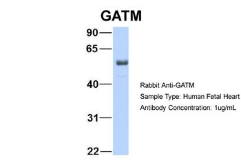 GATM Rabbit Polyclonal Antibody