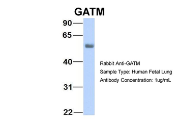 GATM Rabbit Polyclonal Antibody