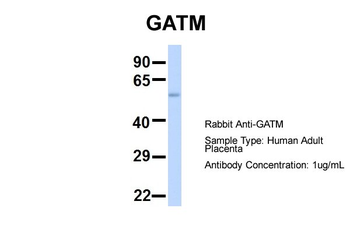 GATM Rabbit Polyclonal Antibody