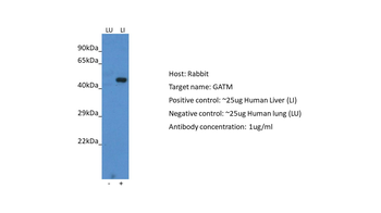 GATM Rabbit Polyclonal Antibody
