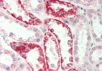 GATM Rabbit Polyclonal Antibody