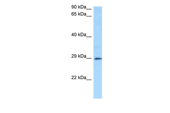 GSTA4 Rabbit Polyclonal Antibody