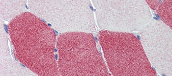 HMGCS1 Rabbit Polyclonal Antibody