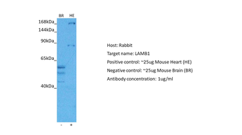 LAMB1 Rabbit Polyclonal Antibody