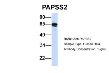 PAPSS2 Rabbit Polyclonal Antibody