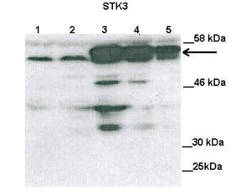 STK3 Rabbit Polyclonal Antibody