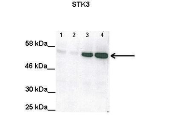 STK3 Rabbit Polyclonal Antibody