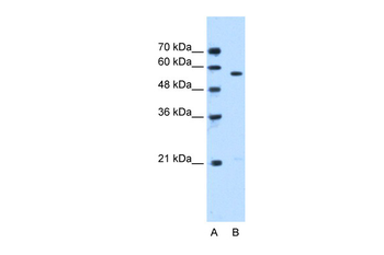 STK3 Rabbit Polyclonal Antibody