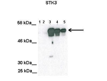 STK3 Rabbit Polyclonal Antibody