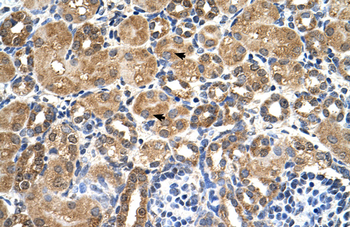 STK3 Rabbit Polyclonal Antibody