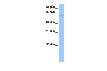 STK39 Rabbit Polyclonal Antibody