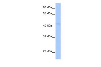 LIPT1 Rabbit Polyclonal Antibody