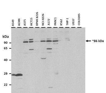NSUN2 Rabbit Polyclonal Antibody