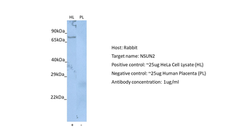 NSUN2 Rabbit Polyclonal Antibody